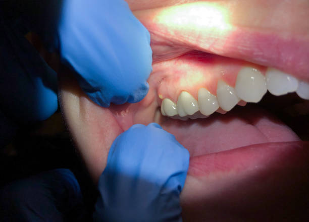 Best Pediatric Emergency Dentist in North Sioux City, SD